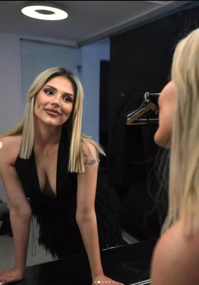 Kısmetse Olur'dan diskalifiye edilen Aybüke Çangal'ın estetiksiz hali ifşalandı! Kısmetse olur Aybüke estetik yaptırdı mı? 4